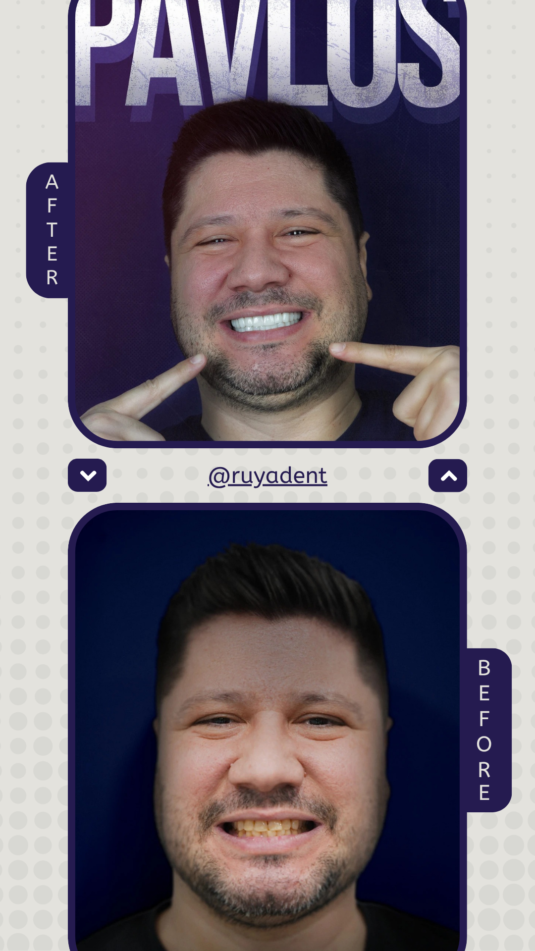 Grey-And-Black-Photo-Collage-Before-After-Beauty-Instagram-Story-_5_