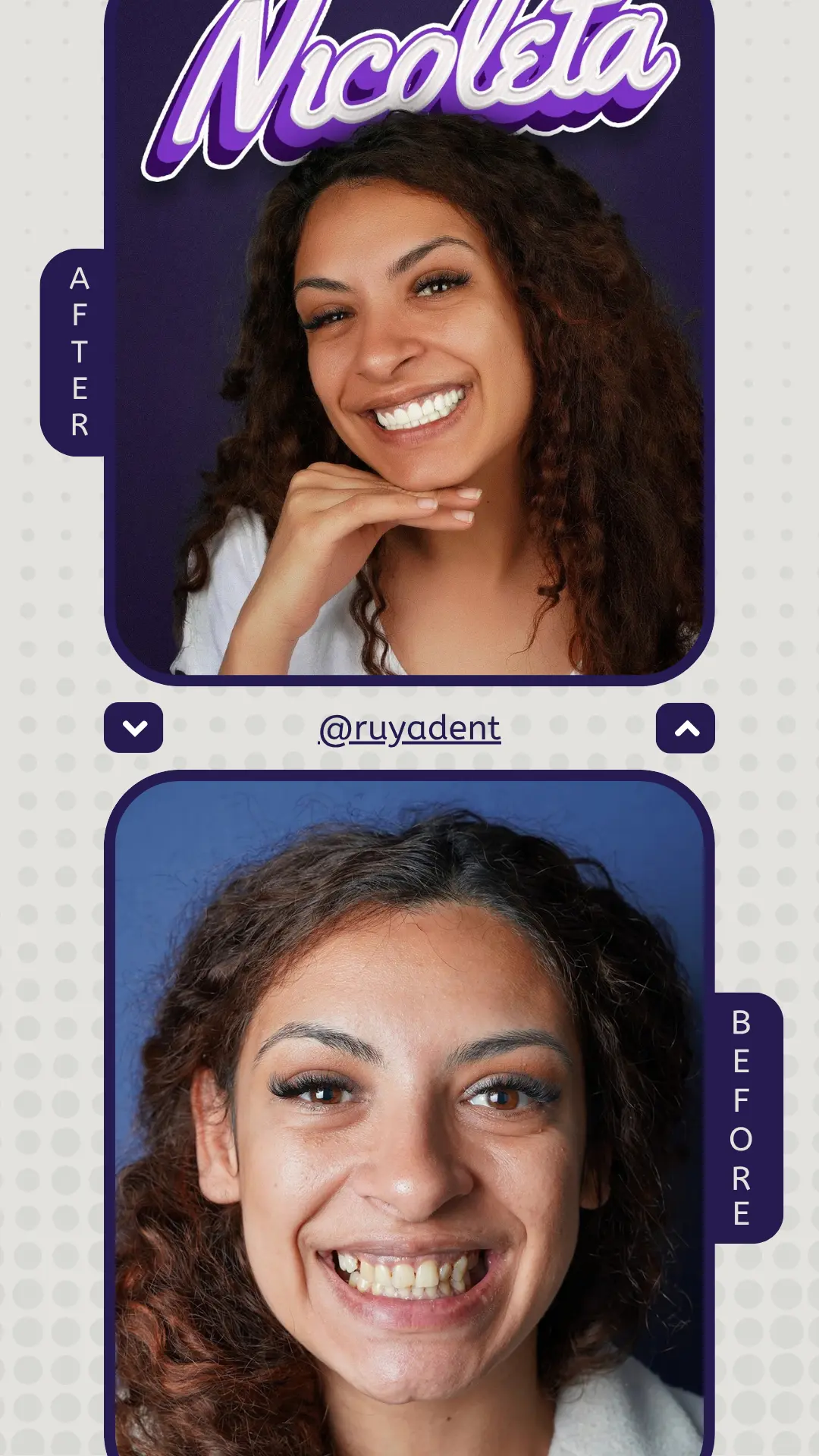 before-after